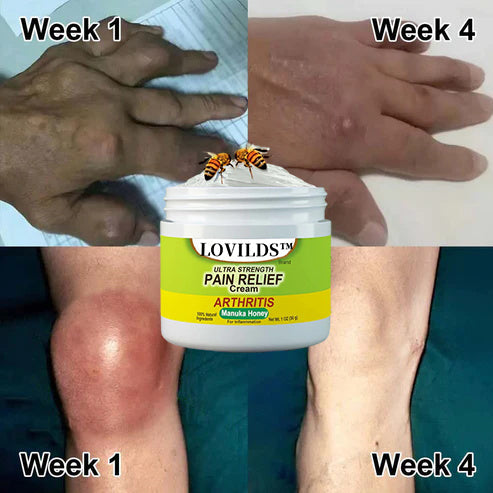 🐝LOVILDS™Bee Toxin Joint and Bone Therapy Advanced Cream👩‍🔬 USP Recommended